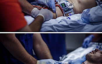 BLS vs. ACLS: Understanding the Differences and When Each is Needed